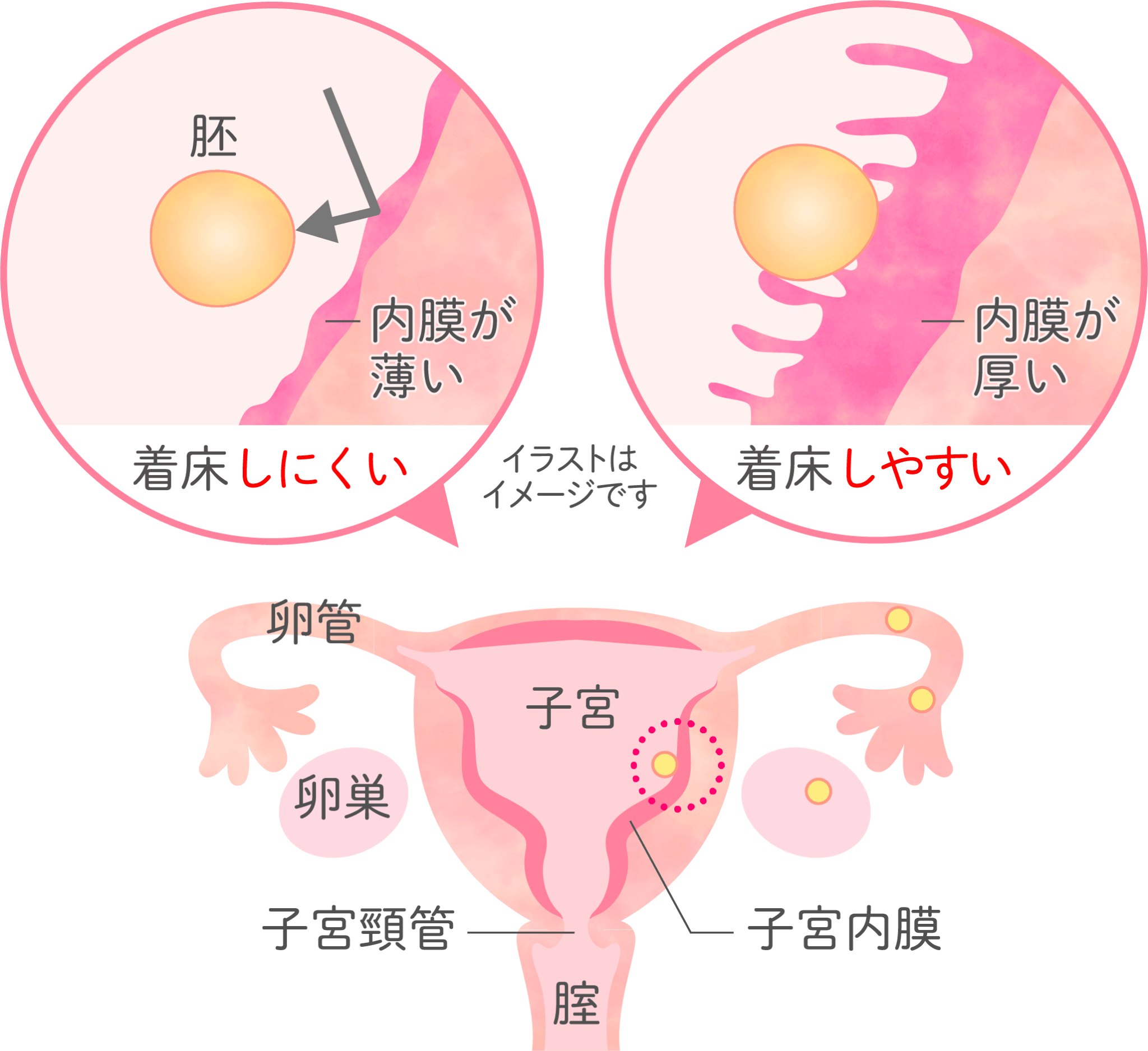 子宮内膜の厚さによる比較