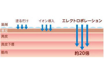 エレクトロポレーション（電気穿孔法）