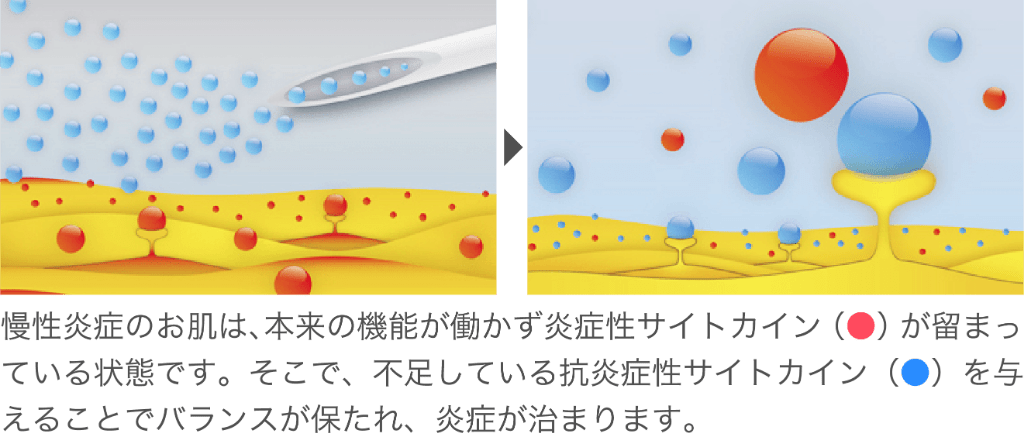 抗炎症性サイトカインが高濃度