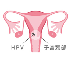 子宮頸部 ＨＰＶ