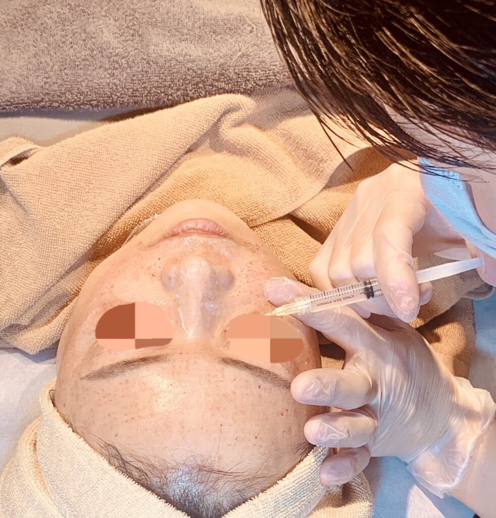 真皮線維芽細胞は神経をつなぐ？！