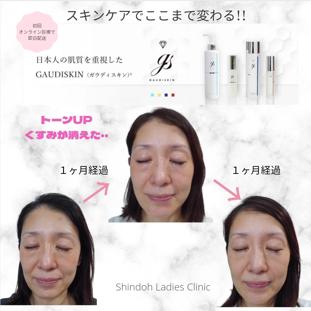 スキンケアは侮るなかれ？！こんなに変われる医療専売スキンケアの実力