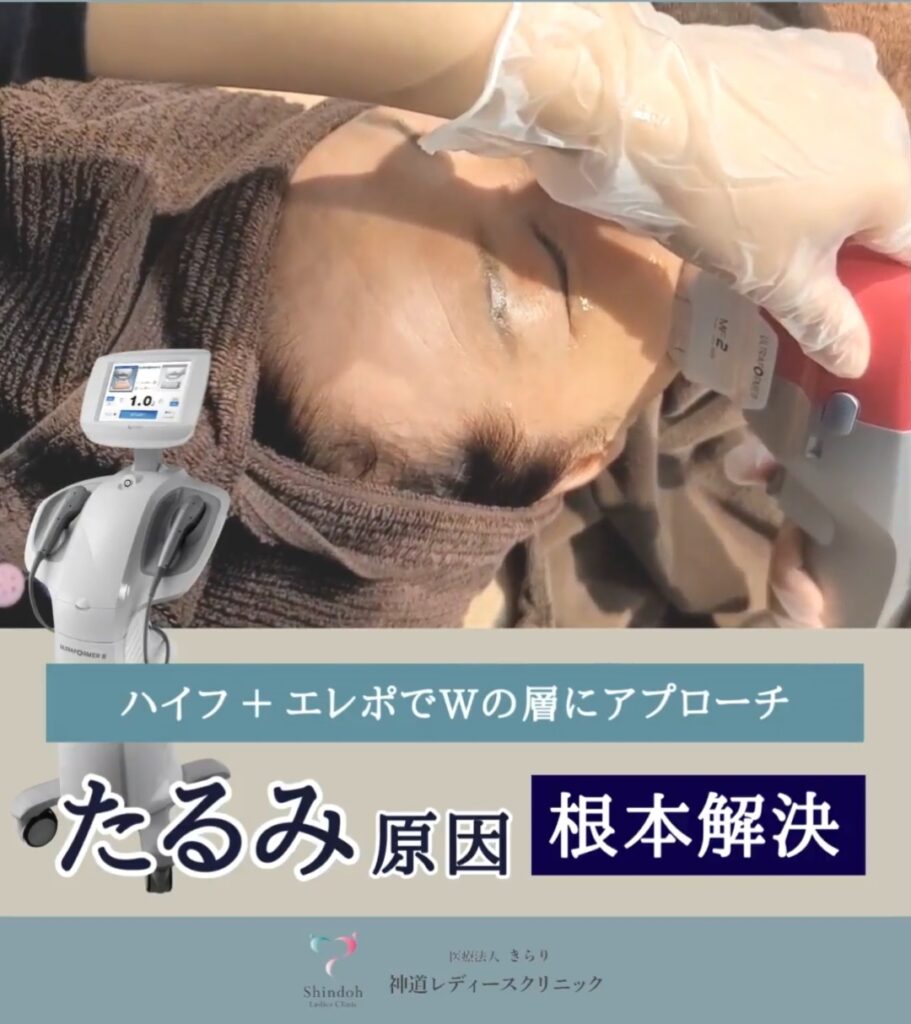 【最新/HIFU】ウルトラフォーマーⅢで小顔&たるみ改善!効果・痛み・回数を徹底解説