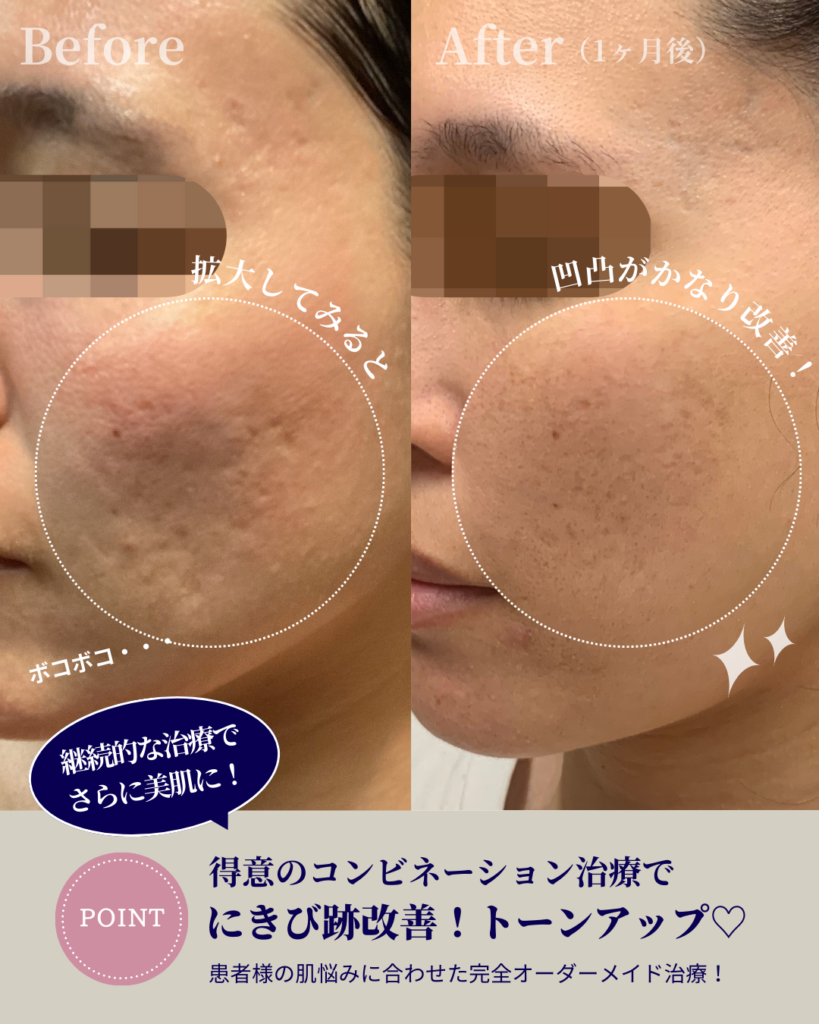1万円台から始める肌管理🪞✨｜門真市で続けやすい美容皮膚科なら神道レディースクリニック